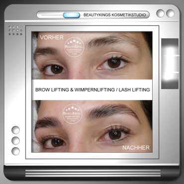 Perfektes Ergebnis nach dem Augenbrauenlifting bei Beautykings